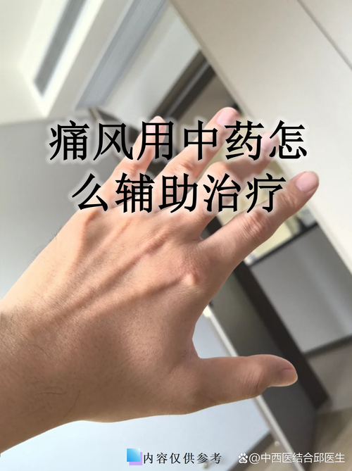 风湿类风湿治疗询前海