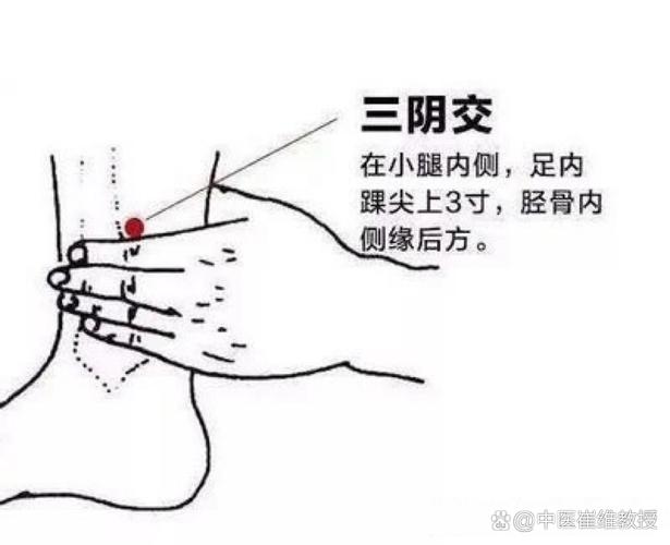 三阴交穴位可以拔罐吗