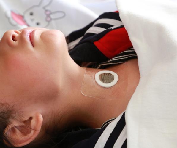 益苼堂穴位贴敷治疗贴