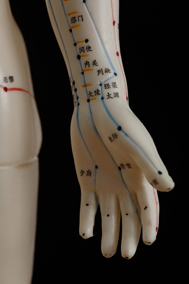 类风湿关节炎针灸穴位