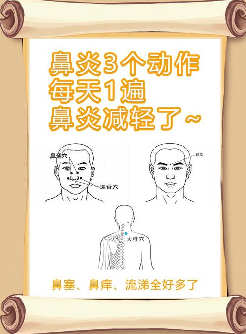 鼻炎的6个穴位治疗法