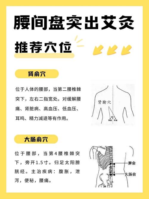 腰间盘突出艾灸穴位图