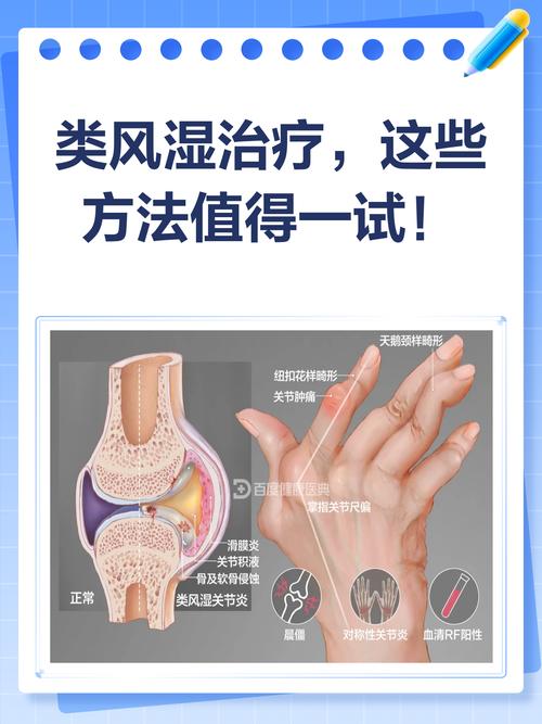 风湿类风湿怎么治会好