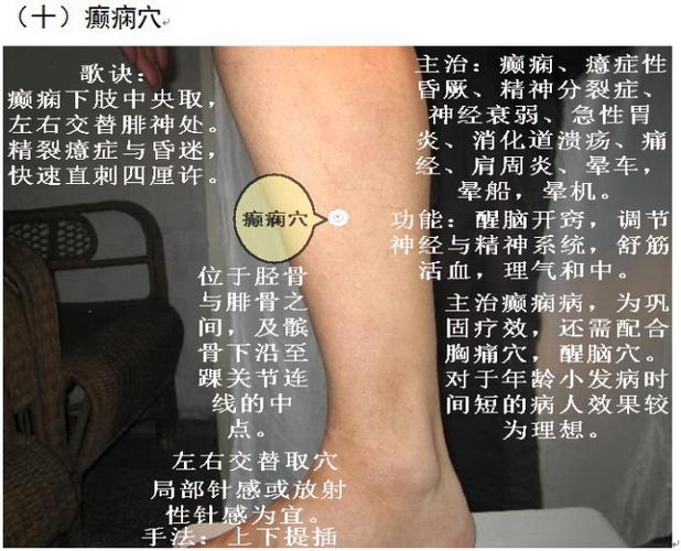 王文远平衡针灸穴位图