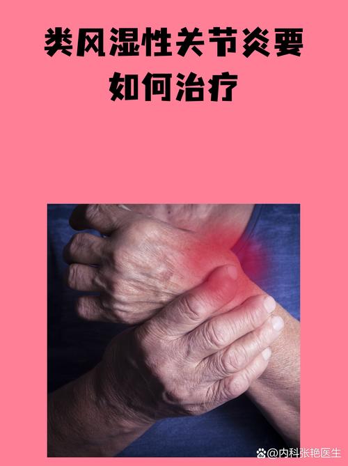 风湿和类风湿会头晕吗