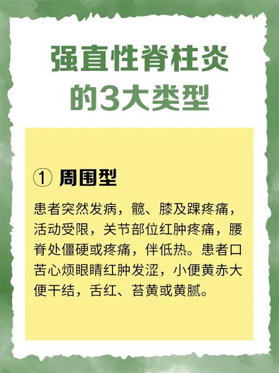 强直是风湿和类风湿吗