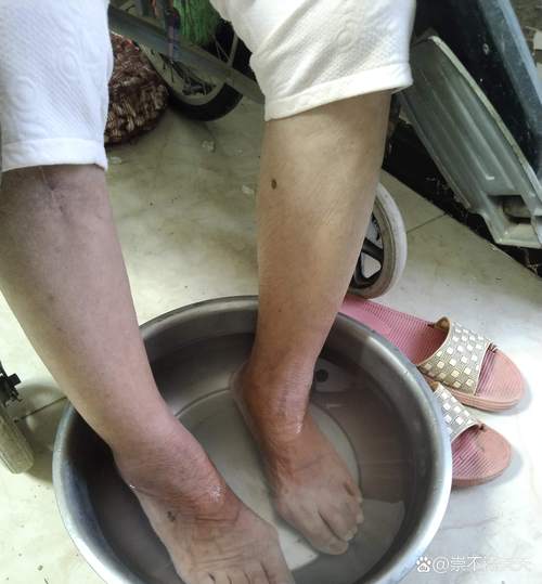 老年人心梗脑梗不排便