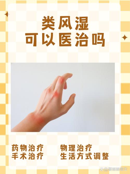 风湿会转化为类风湿么