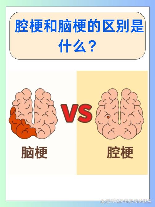 腔梗和脑梗哪个愛复发