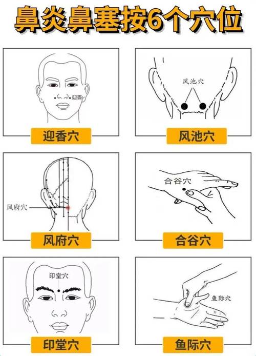 过敏性鼻炎艾灸穴位图