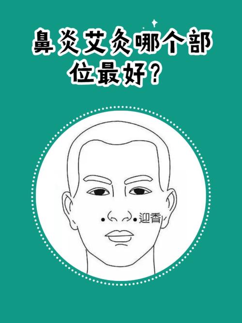 过敏性鼻炎艾灸穴位图