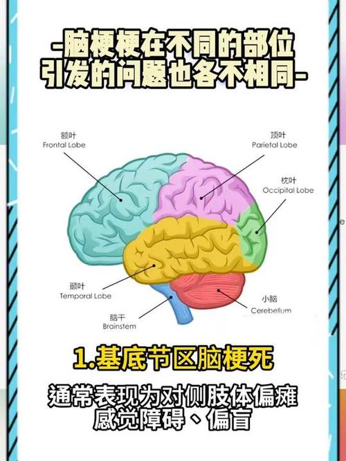 脑梗与枪梗有什么不同