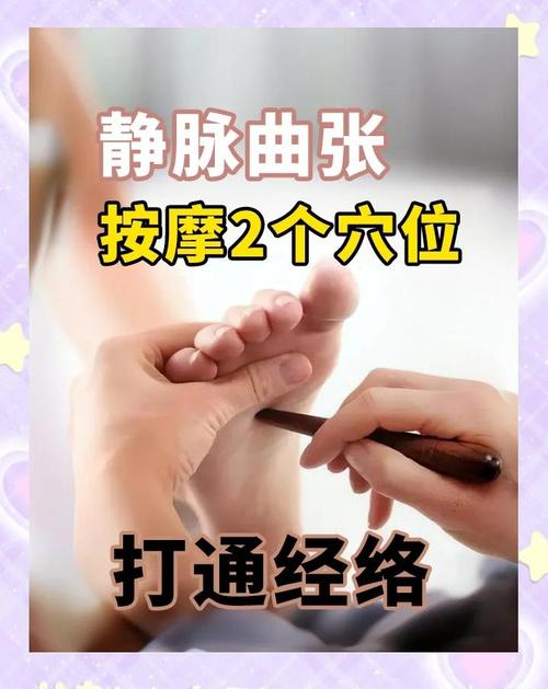 那个穴位对静脉曲张好