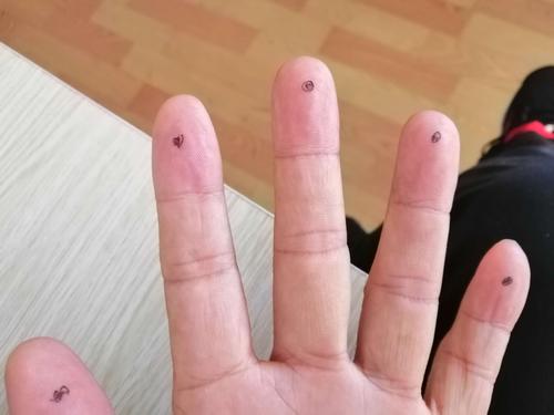 手指放血 脑梗 果壳