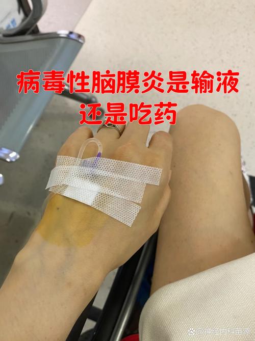 脑梗病人 低烧 消炎