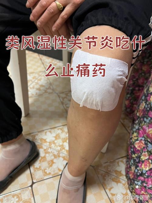 风湿类风湿治疗去前海