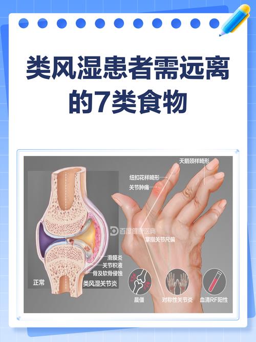 风湿类风湿该吃些什么