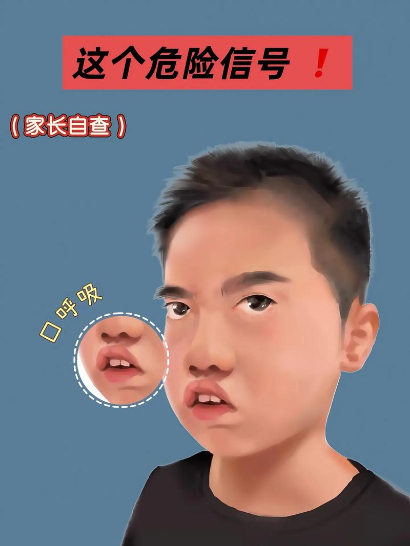 高龄老梗脑梗用嘴呼吸