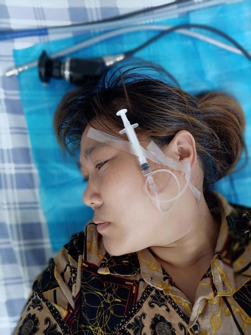 高龄老梗脑梗用嘴呼吸