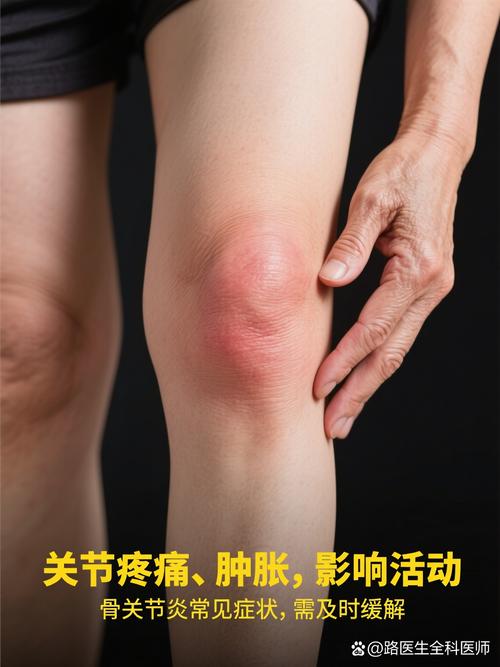 女人大腿痛风湿类风湿