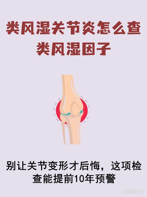 查风湿和类风湿怎么查