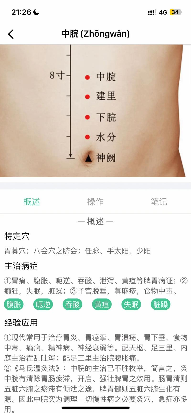 胃疼怎么快速缓解穴位