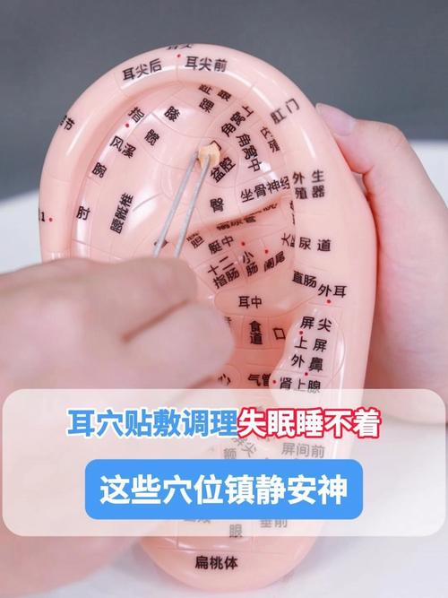 耳朵上治疗失眠的穴位