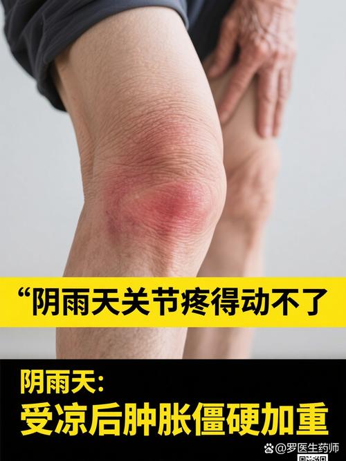 风湿类风湿走不动路了