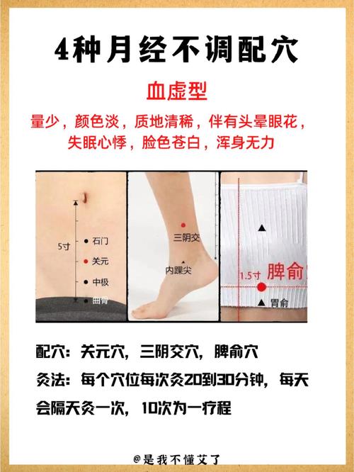月经不调针灸什么穴位