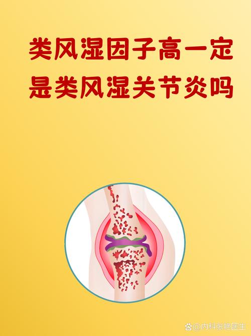 风湿关节炎有风湿因子