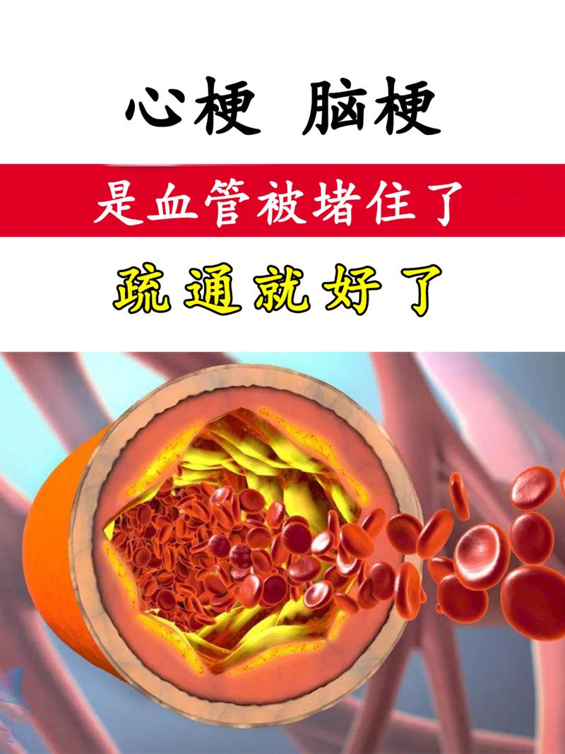 脑梗心梗做什么检查好