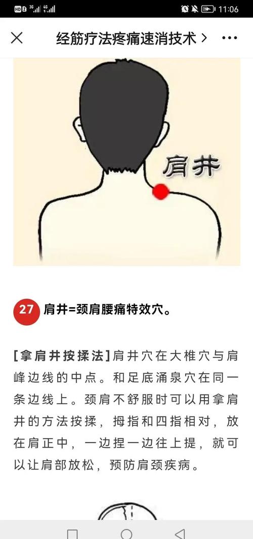 拔罐治疗肩周炎的穴位