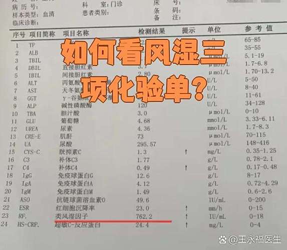 风湿三项检查没有风湿