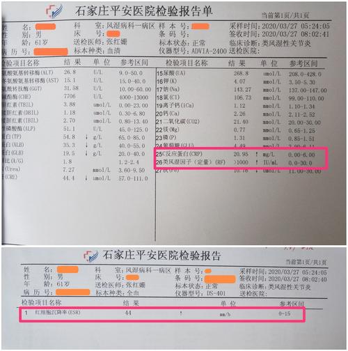 风湿三项检查没有风湿
