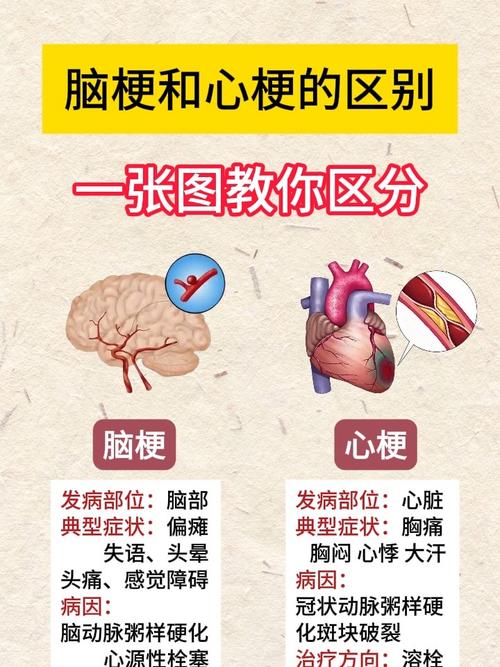 脑梗加心梗是不是大病