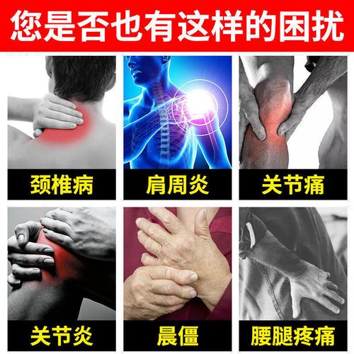 风湿类风湿冷敷贴作用
