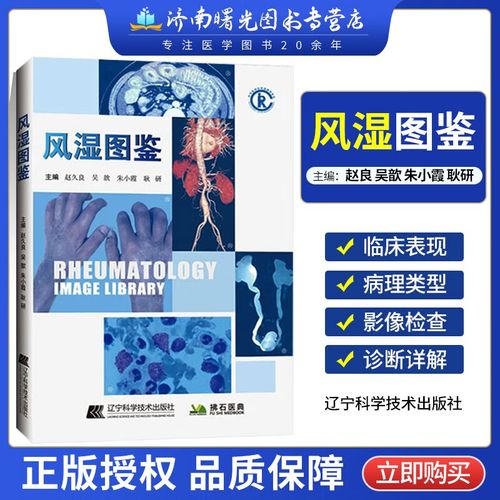 风湿类风湿的检查费用