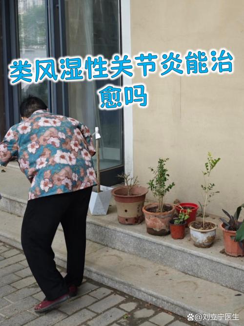 天津去哪看风湿类风湿