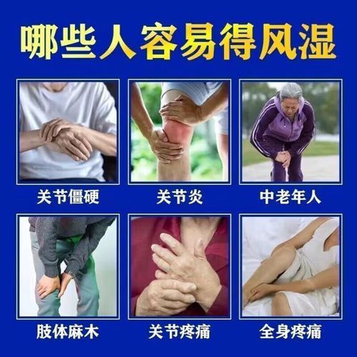 治疗风湿类风湿外用药
