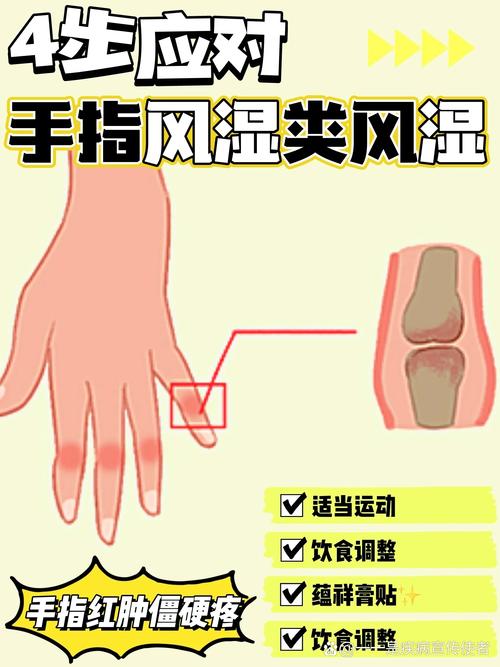 手疼是风湿还是类风湿