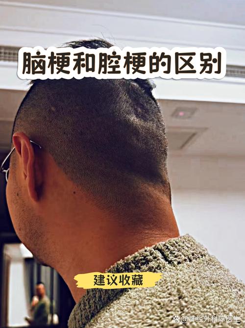 轻度脑梗和腔梗的区别