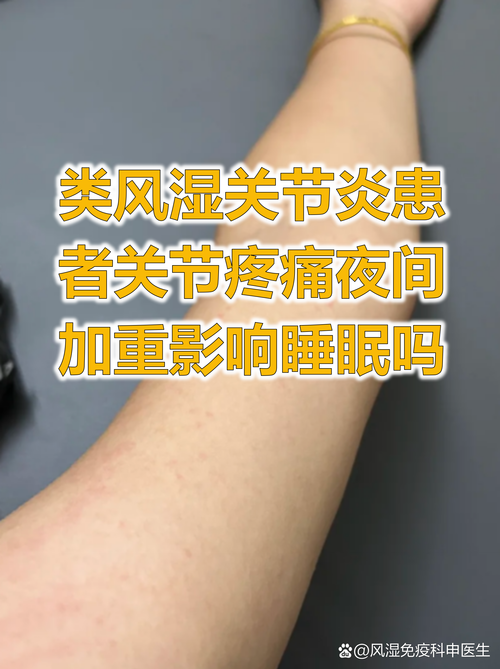 肾脏风湿科是风湿科吗