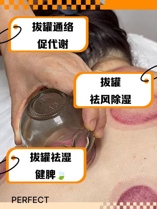 感冒拔火罐拔哪个穴位