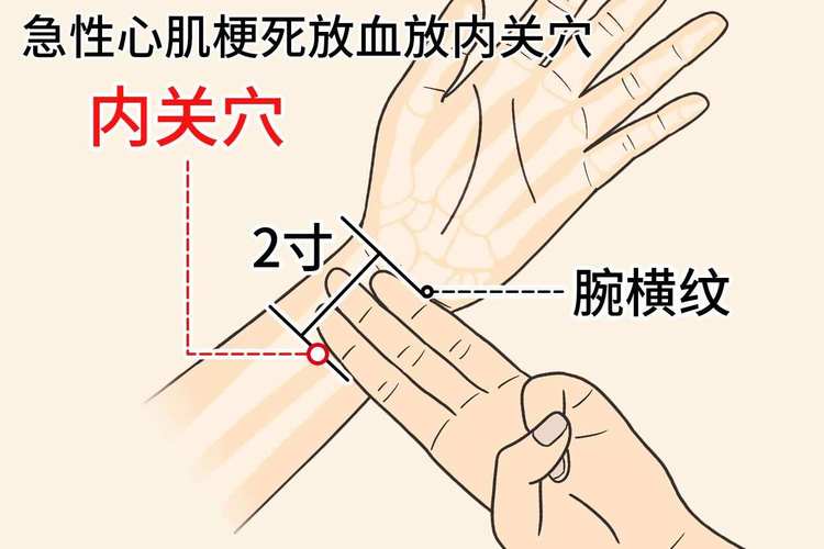 心肌缺血按摩哪个穴位