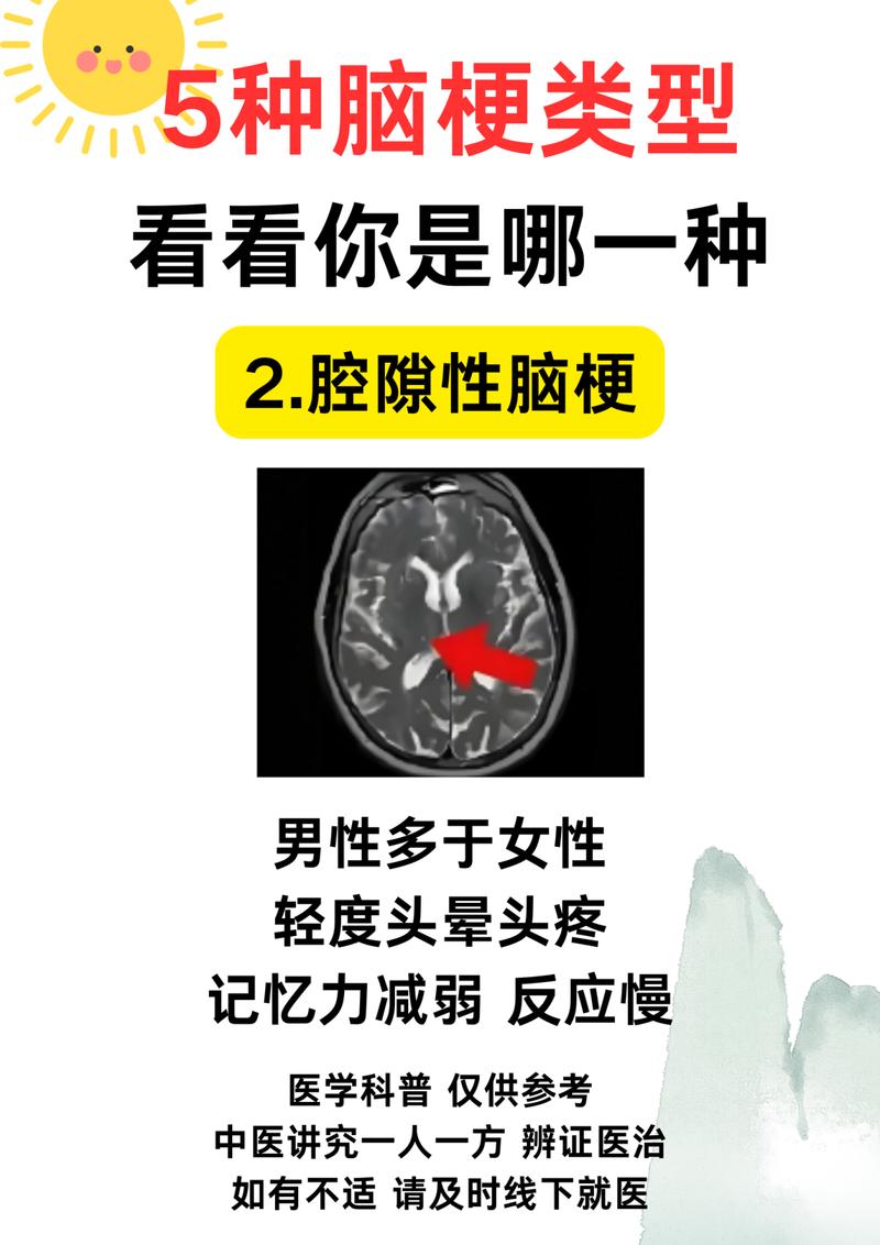脑流图可以确定脑梗吗