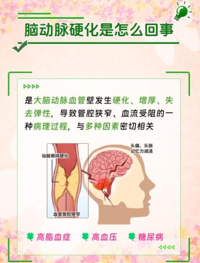 脑梗也是脑动脉硬化吗
