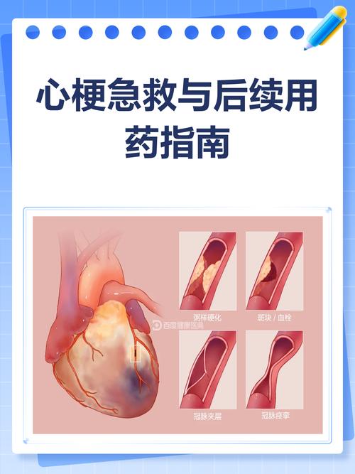 心梗和脑梗的用药区别