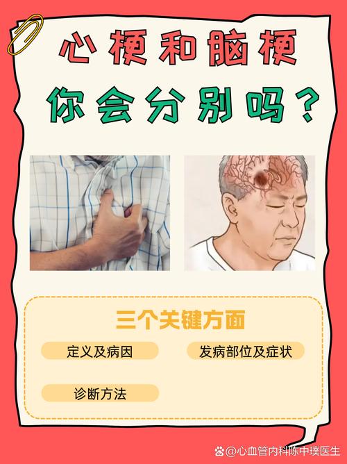 脑梗患者可能会心梗吗