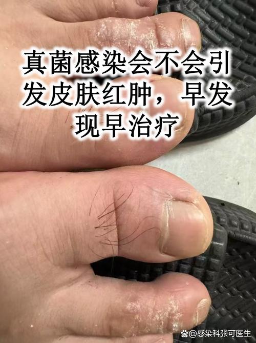 长春苏英杰风湿类风湿