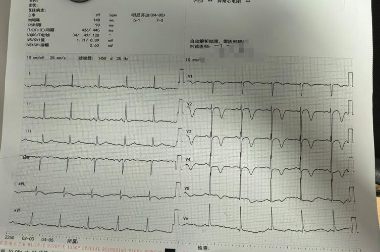 我妈有心梗脑梗老卡痰